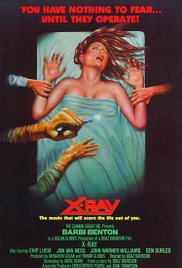 Watch Full Movie :XRay (1981)