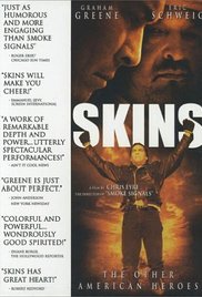 Watch Full Movie :Skins (2002)